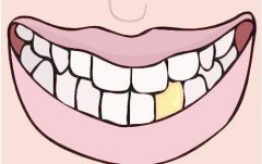 色素牙可以通过哪种方式进行美白？