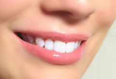 如何快速解决畸形牙造成的困扰？