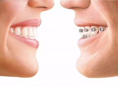 牙齿不齐造成的危害有哪些你知道吗？