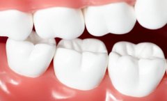 全瓷牙的保质期有多久你知道吗？