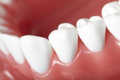 牙齿出现以下症状可以选择皓齿美白