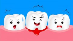 教你怎么处理牙龈出血现象？