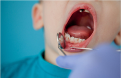 天津海德堡联合口腔儿牙医生详解什么是窝沟封闭