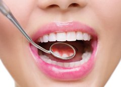天津海德堡联合口腔医生讲解关于洗牙那些事
