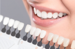 天津海德堡联合口腔医生提醒牙齿贴面的护理方法有哪些