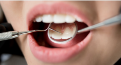 天津海德堡联合口腔医生讲解不定期检查牙齿的后果！