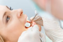 天津海德堡联合口腔医生讲解牙齿一生的变化？