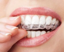 天津海德堡联合口腔医生讲解牙齿正畸需要多久？