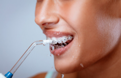 海德堡联合口腔医生讲解洗牙能预防哪些口腔问题？
