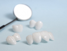 天津海德堡联合口腔医生讲解补牙齿后多久能吃东西？