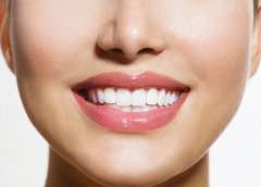 天津海德堡联合口腔医生讲解洗牙和牙齿美白是两码事儿！